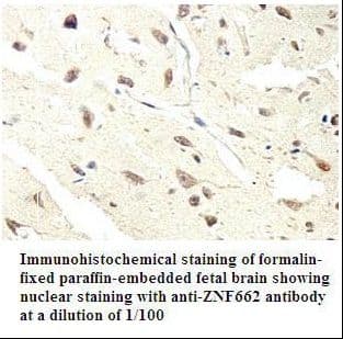 ZNF662 Antibody (aa9-299)