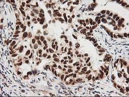 ERCC4 / XPF Antibody (clone OTI4E11)