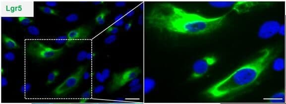 GPR49 / LGR5 Antibody (aa250-550, clone OTI2A2)