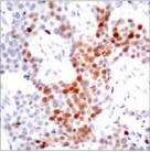 ATF2 Antibody