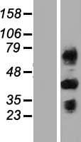 C4BPB / C4BP Beta Protein (Over-Expression Lysate Myc-DDK (Flag))