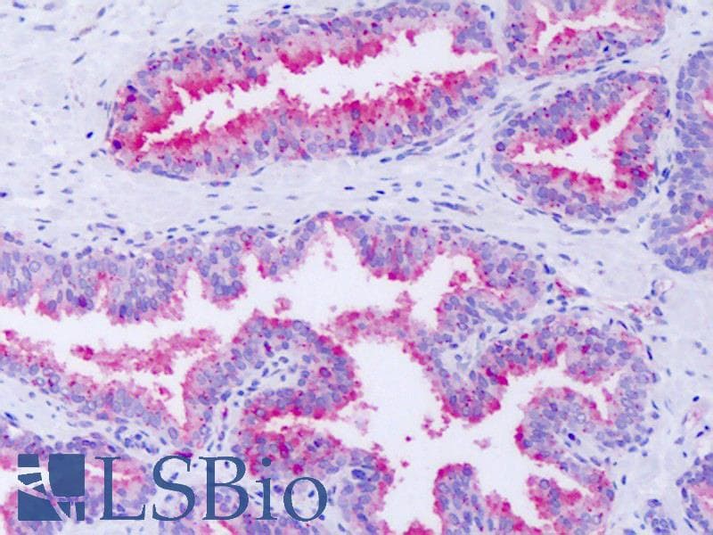 IHC-plus™ Polyclonal Rabbit anti-Human GPR63 Antibody (Cytoplasmic Domain, IHC)