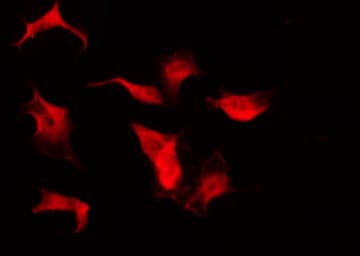 SMC1A / SMC1 Antibody (phospho-Ser957)