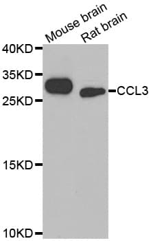 Polyclonal Rabbit anti-Human CCL3 / MIP-1-Alpha Antibody (IHC, WB)