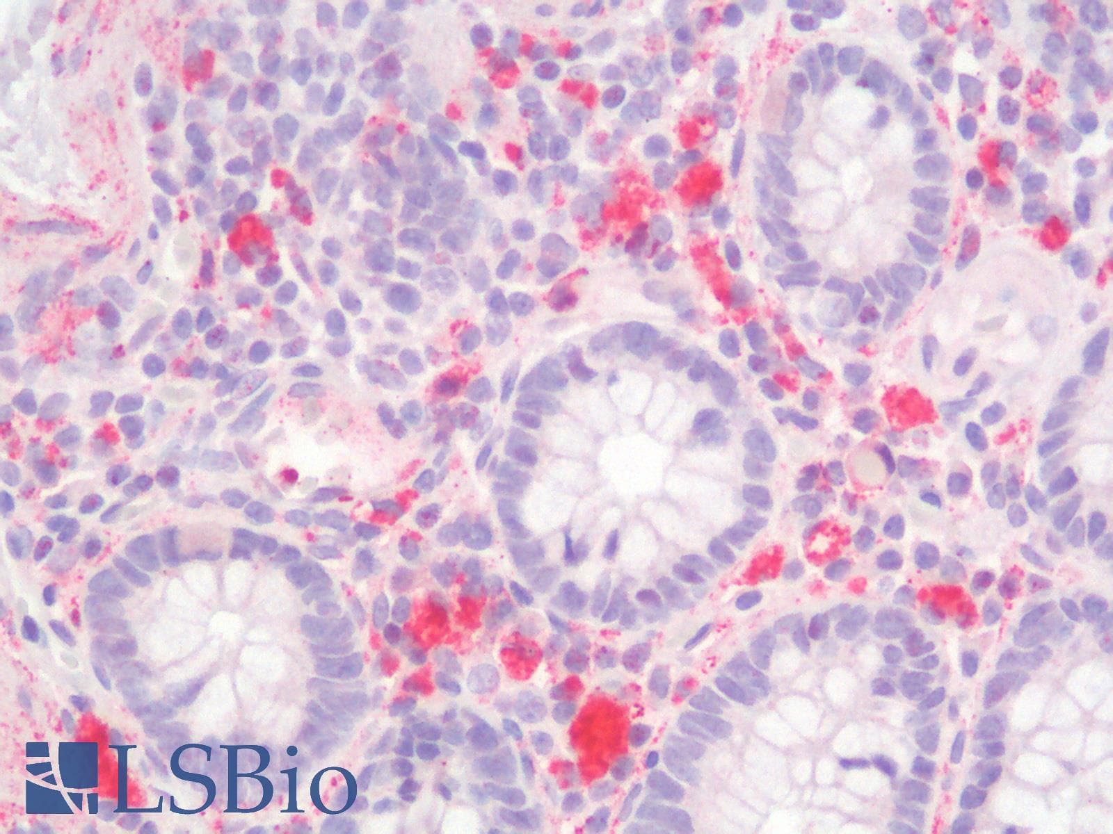 IHC-plus™ IL23A / IL-23 p19 Antibody