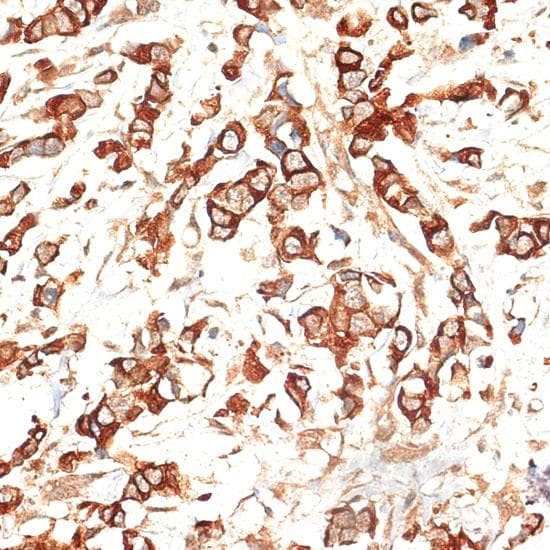 KRT13 / CK13 / Cytokeratin 13 Antibody
