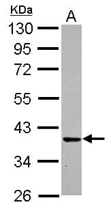 IHC-plus™ CDK6 Antibody