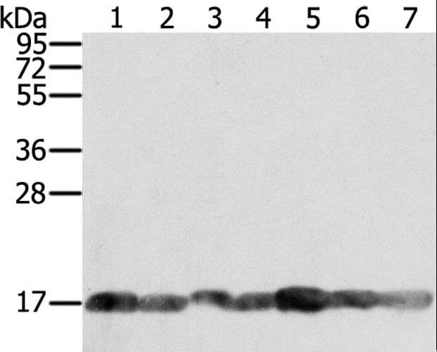 Polyclonal Rabbit anti-Human PPIA / Cyclophilin A Antibody (IHC, WB)