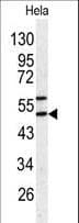 Polyclonal Rabbit anti-Human SERPINH1 / HSP47 Antibody (aa390-418, IHC, WB)