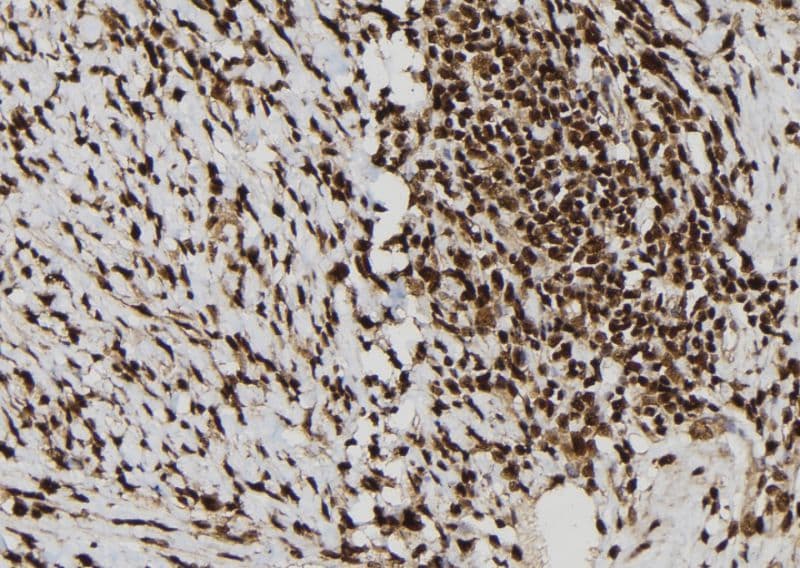 CALB2 / Calretinin Antibody