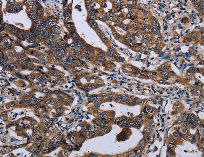 LZTFL1 Antibody