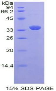 Rat BLIMP1 / PRDM1 Protein (Recombinant His-T7)