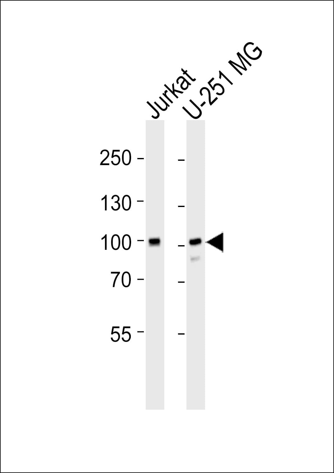 MORC2 Antibody (aa828-862)