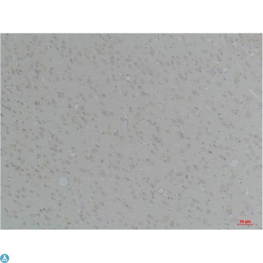 Mouse Anti-Human IgG Fc Secondary Antibody (HRP)