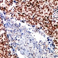 Polyclonal Rabbit anti-Human SRF / Serum Response Factor Antibody (IHC, WB)