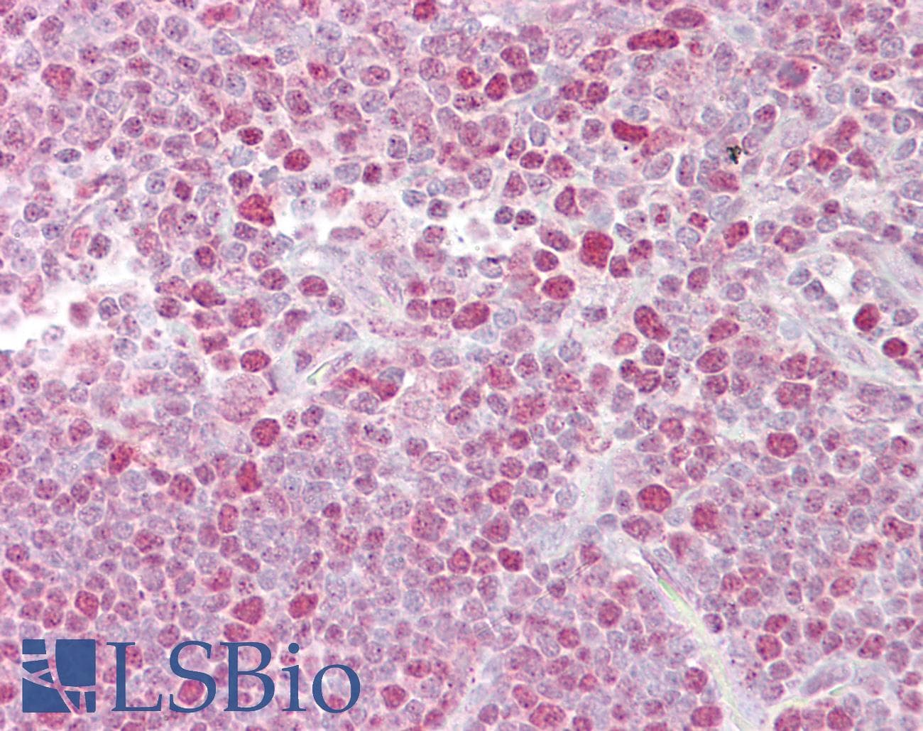NFAT1 / NFATC2 Antibody (C-Terminus)