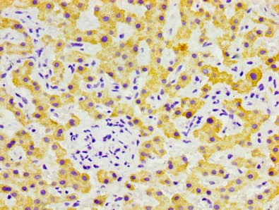 FGL1 / Hepassocin Antibody