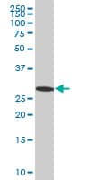 IHC-plus™ Monoclonal Mouse anti-Human EFHD1 Antibody (clone 1H7, IHC, IF, WB)