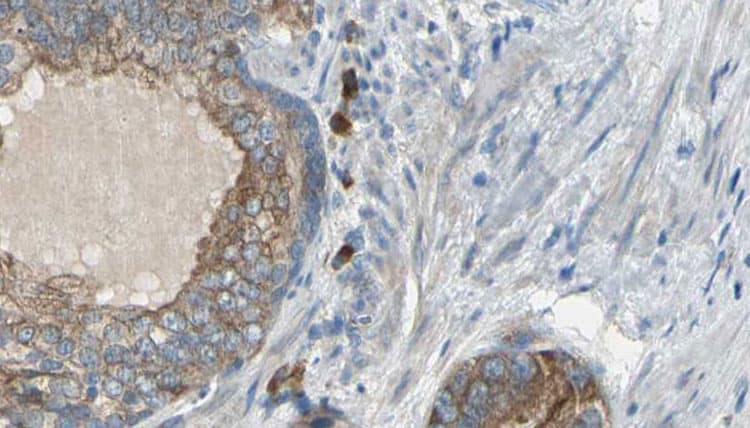 CCT6A Antibody