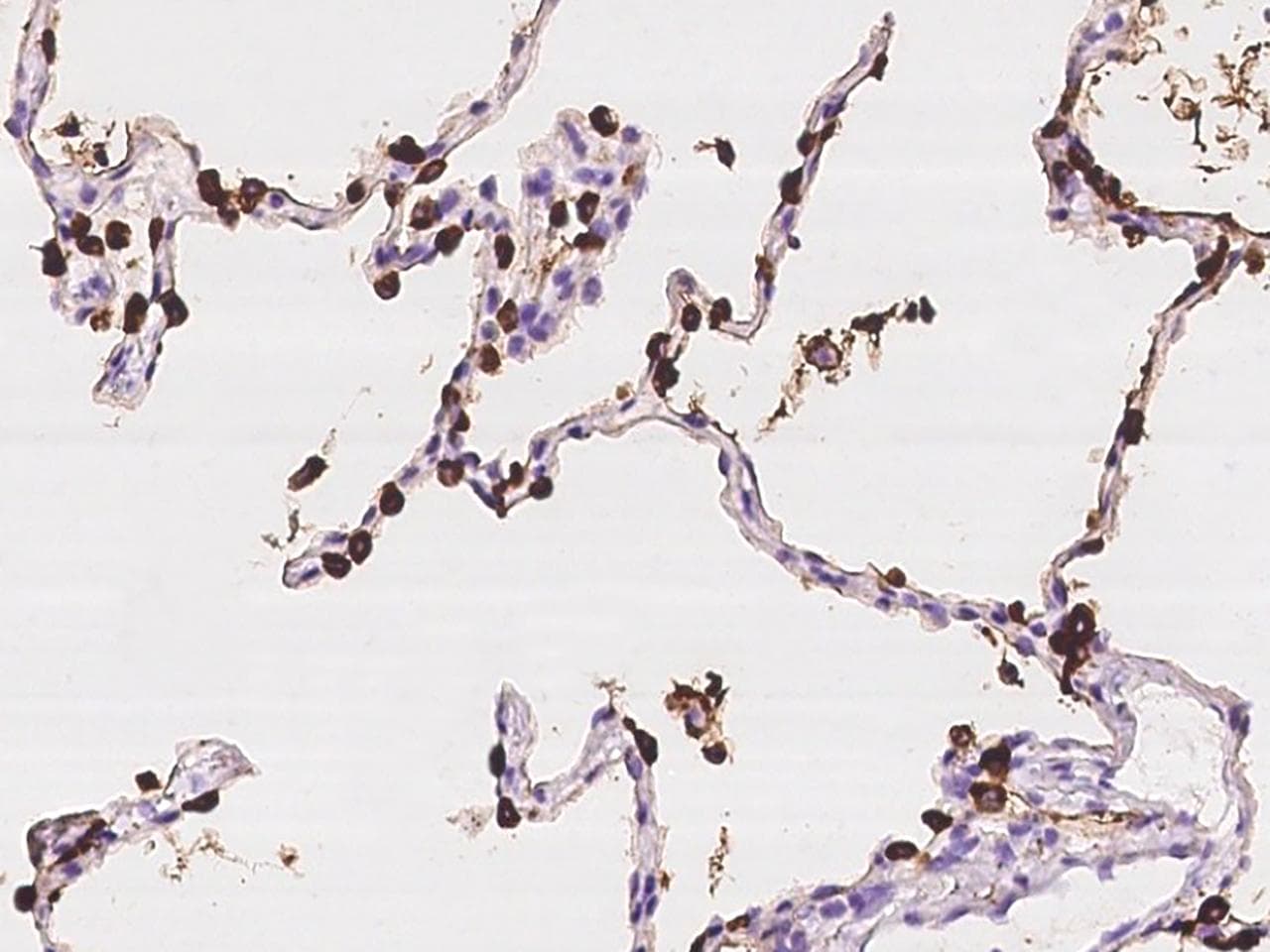 Polyclonal Rabbit anti-Human SFTPA1 / Surfactant Protein A Antibody (IHC)