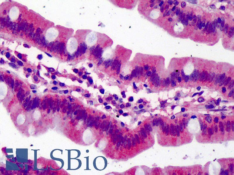 IHC-plus™ FANCD2 Antibody (clone 6, Preservative Free)