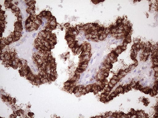 Monoclonal Mouse anti-Human NR2C2 / TAK1 Antibody (clone OTI1E1, aa1-241, IHC, WB)