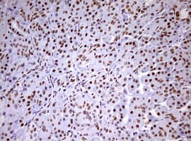 DDX56 Antibody (aa323-547, clone OTI2E5)