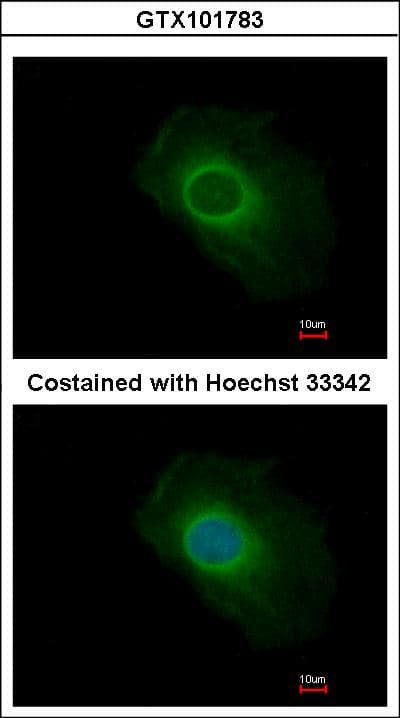 SERP1 Antibody (aa1-51)