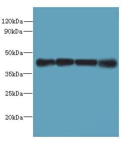 MAGEB18 Antibody