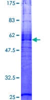 Human MC3R / MC3 Receptor Protein (Recombinant GST)