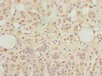 TBC1D14 Antibody