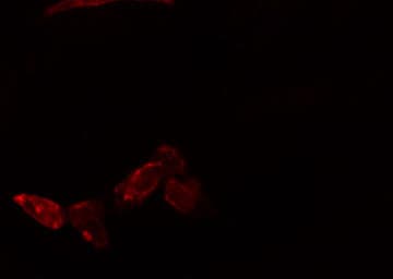 RPL23 / Ribosomal Protein L23 Antibody