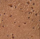 BABAM1 / HSPC142 Antibody (aa116-143)