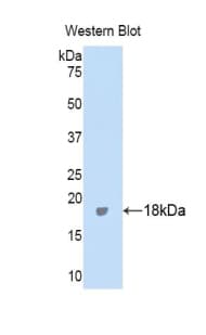 ITIH4 Antibody (aa273-424)
