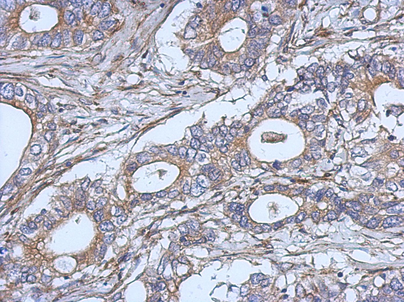 IL2 Antibody