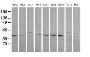 MAP2K3 / MEK3 / MKK3 Antibody (clone OTI5F9)