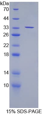 Mouse SUV420H2 Protein (Recombinant His)