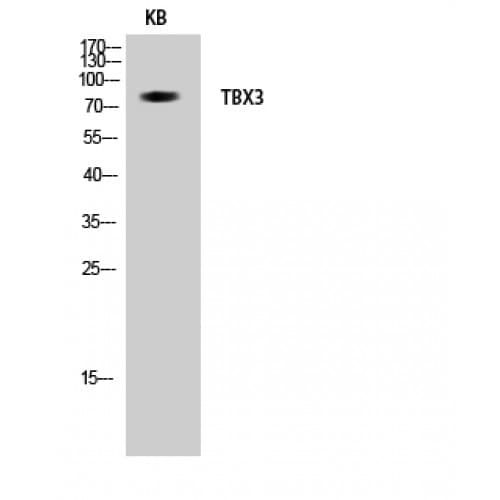 TBX3 Antibody (270-350 aa, Internal)