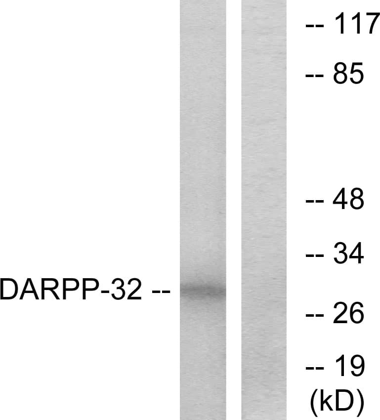 PPP1R1B / DARPP-32 Antibody (aa18-67)