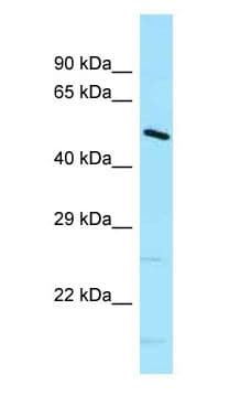 DNAJC21 Antibody (aa151-200)