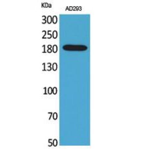 A2M / Alpha-2-Macroglobulin Antibody (Internal)
