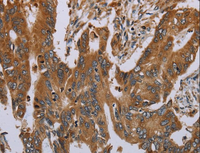 OSM / Oncostatin M Antibody