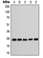 CDKN1B / p27 Kip1 Antibody (phospho-Thr198)