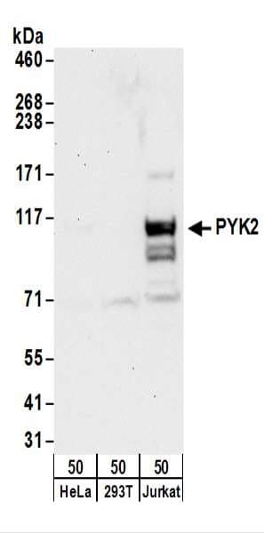 PTK2B / PYK2 Antibody (aa275-325)