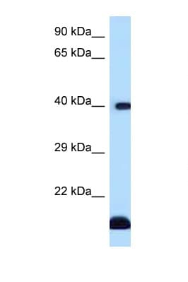 Polyclonal Rabbit anti-Human CD1D Antibody (C-Terminus, WB)