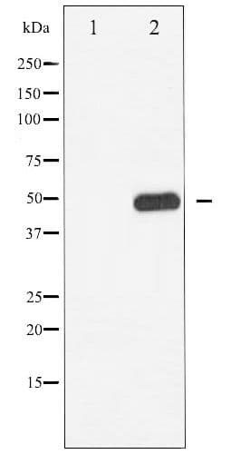 Polyclonal Rabbit anti-Human BLNK Antibody (phospho-Tyr96, IHC, WB)