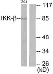 IKBKB / IKK2 / IKK Beta Antibody (aa161-210)
