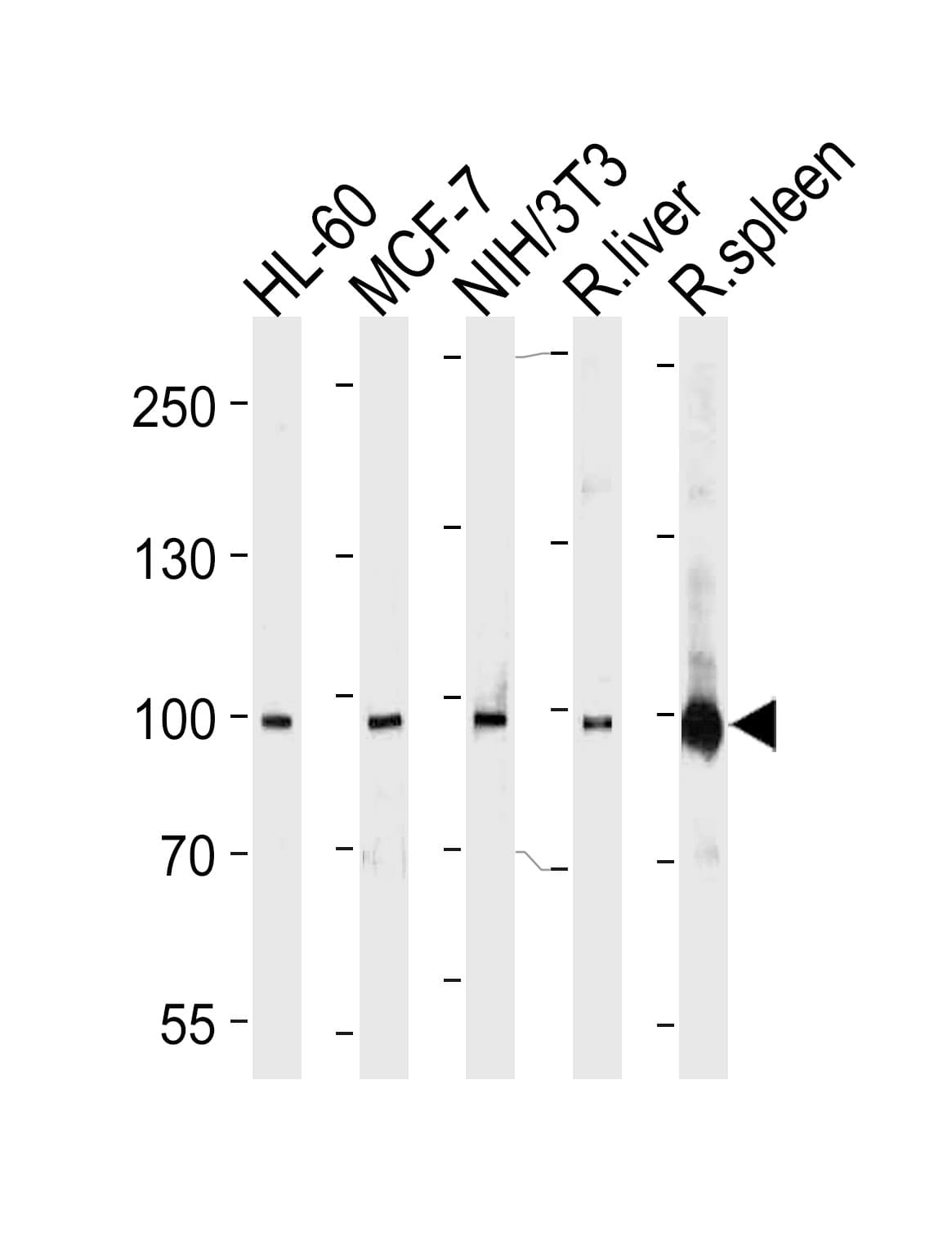 STAT5B Antibody (aa760-787)