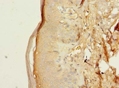Polyclonal Rabbit anti-Human TMEM176B / LR8 Antibody (IHC, WB)
