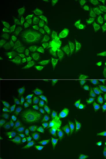 Polyclonal Rabbit anti-Human NDUFS4 Antibody (IF, WB)